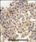 MAP2K1 Antibody (T291)